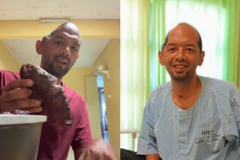 Kisah penjual daging salai perlukan RM15k untuk pembedahan dapat perhatian Perdana Menteri