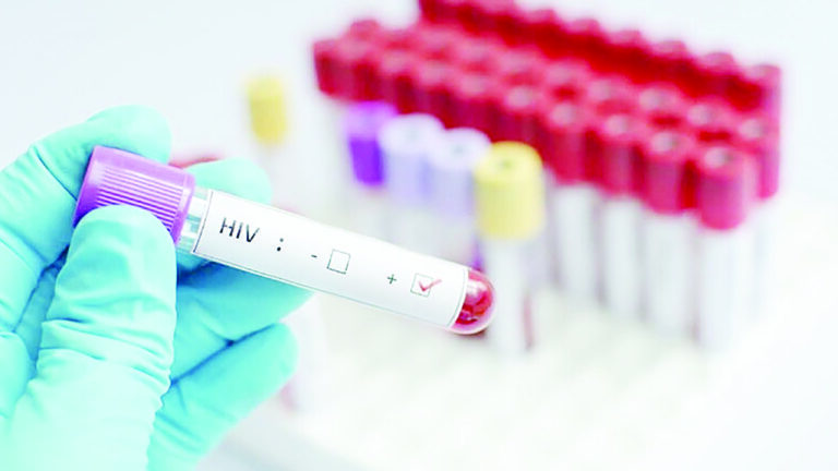 Jangkitan baharu HIV di Malaysia menurun